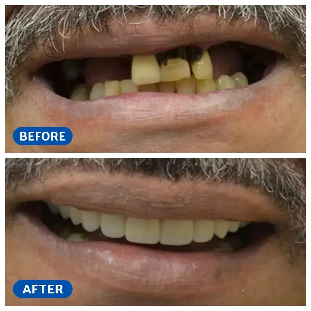 Smile transformation 2